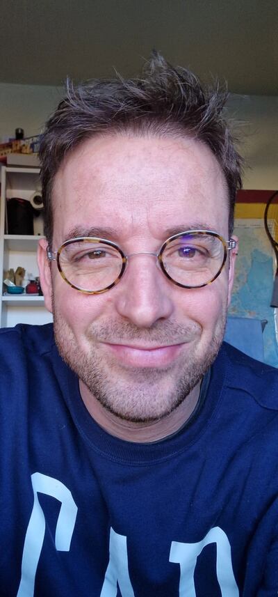 Juan José Manzano since his hair transplant