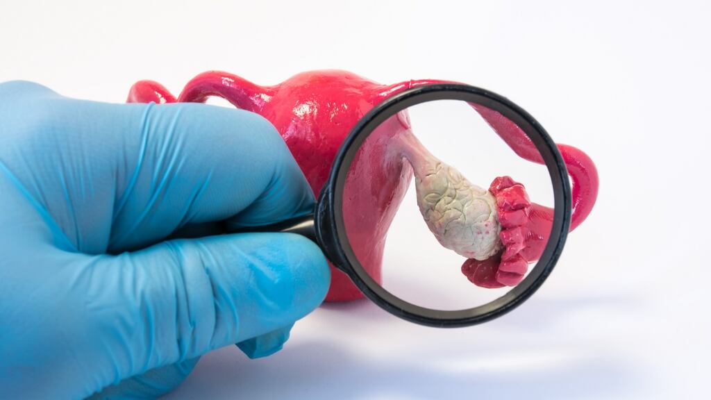 “The typical features of polycystic ovaries – a necklace of tiny follicles around the ovaries – are seen on ultrasound.” Photograph: iStock