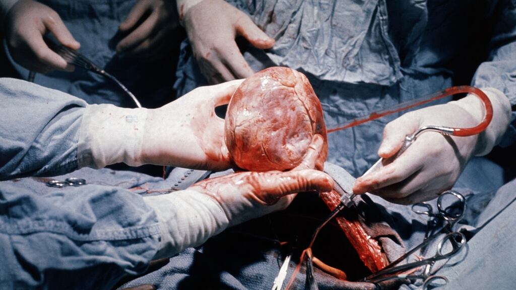 Tale of a heart transplant between a Palestinian man and Israeli man caught up in the conflict was wasted