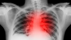 Health: A catalogue of unsettling lapses