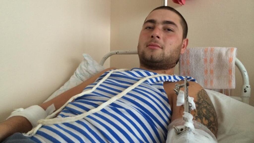 Paratrooper Vadim Polyantsa (25) was hit by shrapnel in his arm and neck as his unit stormed a rebel checkpoint. His rebuilt upper arm will take months to heal. Photograph: Daniel McLaughlin