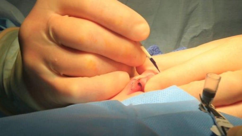 Finesse produces products for wound care and skin treatment, including skin barrier films and protection creams, and silicone and polyurethane foam wound dressings.