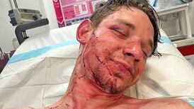 Abbey Theatre condemns ‘random act of mindless violence’ against actor who was bitten and glassed