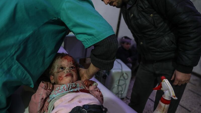 Injured children are treated at a hospital in rebel-held Douma, Eastern Ghouta, Syria, on Monday. Photograph: Mohammed Badra/EPA