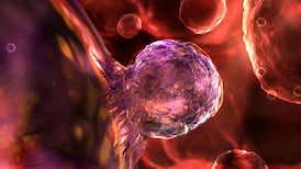 Moving children’s stem cell transplants to Ireland would ‘ease burden’ on patients