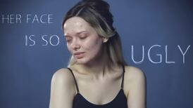 Aisling on Beauty: How an acne sufferer took on the trolls