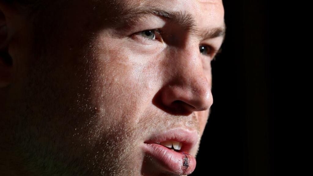 Richardt Strauss: ‘The doctor came in and said ‘Just relax, but it looks like there is a hole in your heart and you might have had a stroke at some stage’. Photograph: Dan Sheridan/Inpho