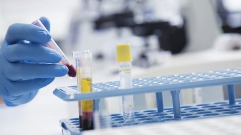 Scientists say they have developed a blood and urine test which can detect autism in children