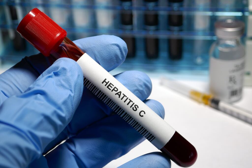 Just one in 1,000 people in Ireland is infected with hepatitis C, a new study has found. Photograph: iStock