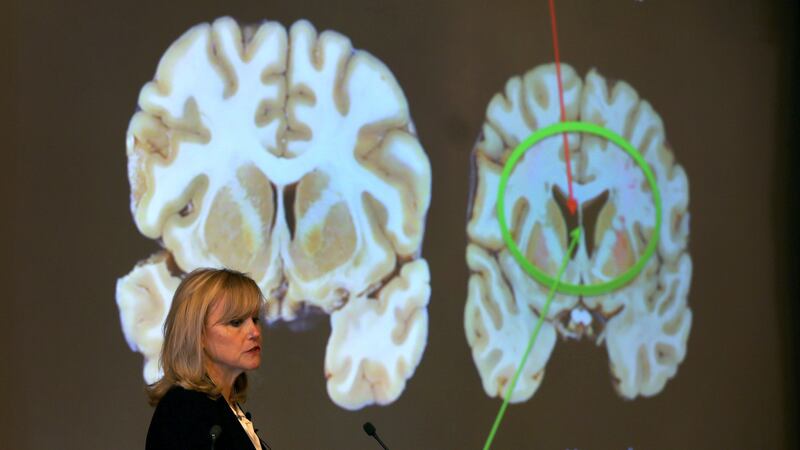 Dr. Ann McKee announces her findings on her examination of the brain of Hernandez. Photo: John Tlumacki/The Boston Globe via Getty Images