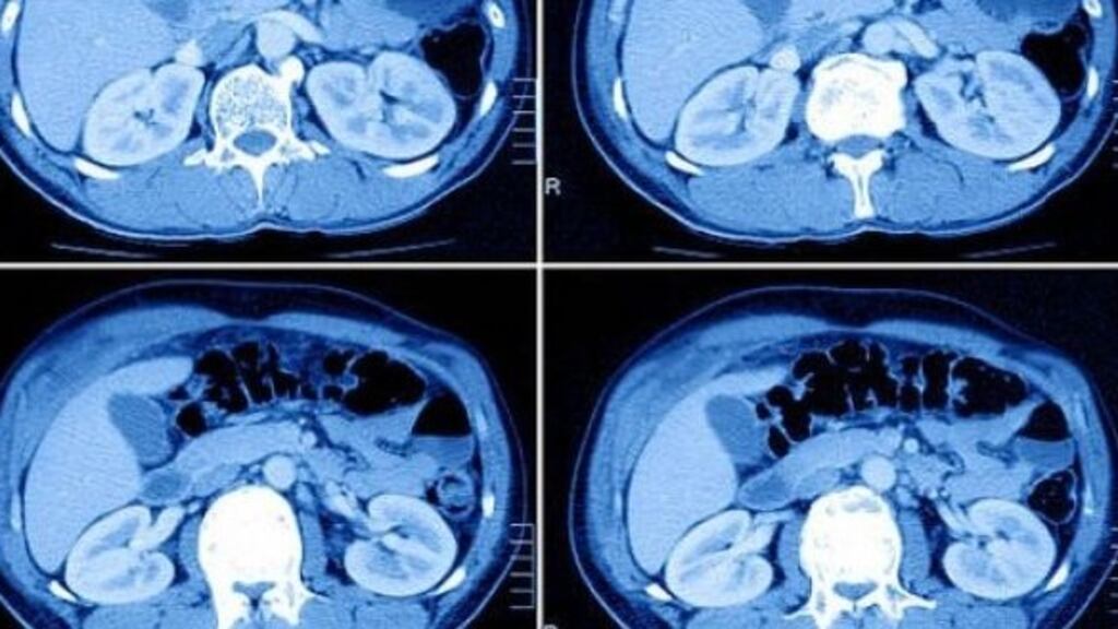 The scans examined, including X-rays, cat scans and ultrasounds, relate to work carried out by one individual who is no longer working at the hospital. Photograph: Getty