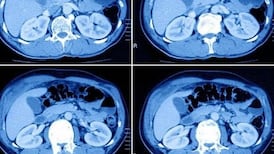 Number of missed diagnoses rises in Kerry hospital scan review