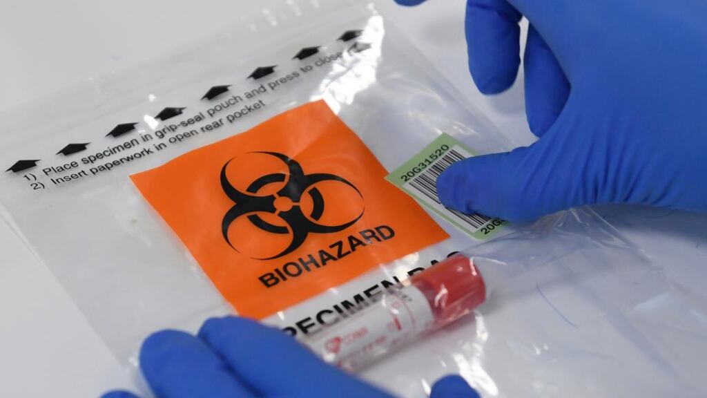 A laboratory technician working with samples of potential Covid-19 taken from patients in Dublin. Photograph: Aidan Crawley/EPA