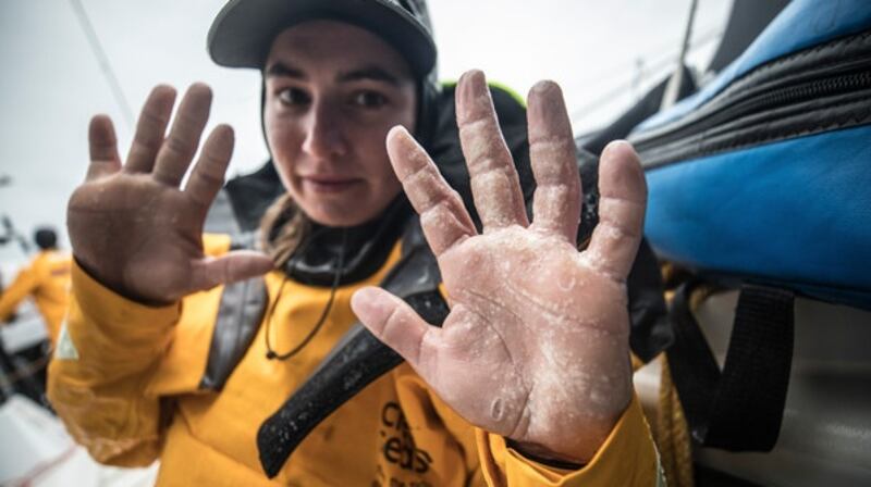 My crewmate Bianca Cook shows the effects of the salt water on ger hands after 15 days at sea. Photo: Sam Greenfield/Volvo Ocean Race