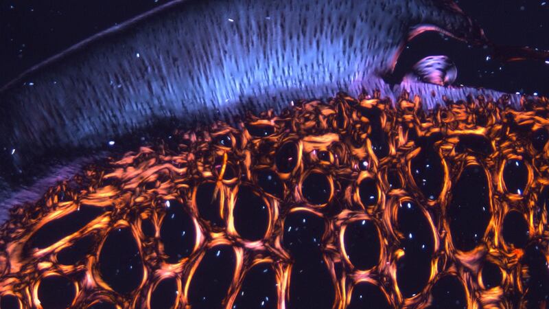 Striking imagery: the histological section of the native osteochondral tissue of the femoral condyle of a two-year-old goat. Photograph: Pedro J Díaz Payno