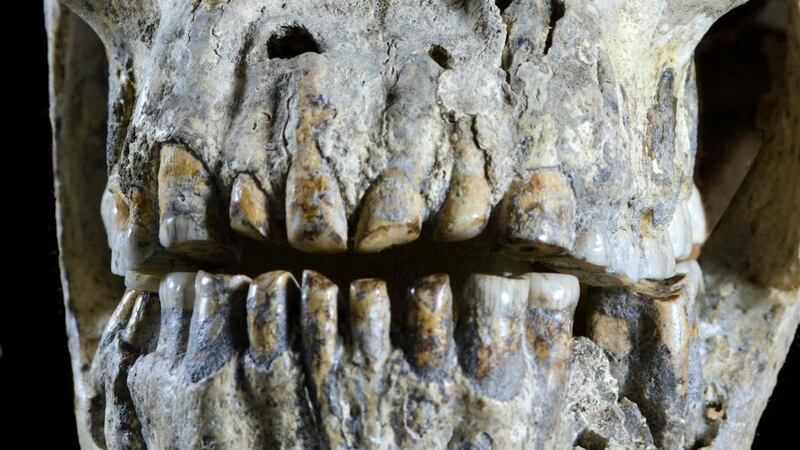 Detail from an undated handout photo of a 1.8-million year-old skull excavated in 2005 in the republic of Georgia.