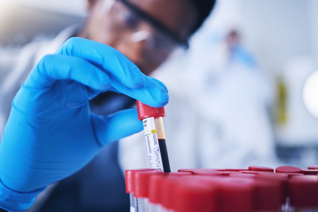 A Swedish study has found that a simple blood test can diagnose Alzheimer's with 90 per cent accuracy. Photograph: iStock