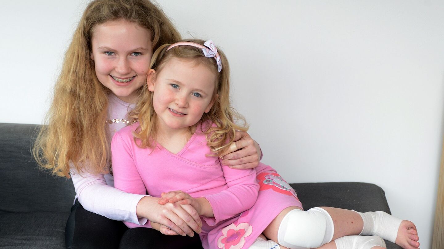 Alison (12) and Erica (6) Hyland, who both have a rare skin condition called epidermolysis bullosa (EB). Photograph: Dave Meehan/The Irish Times