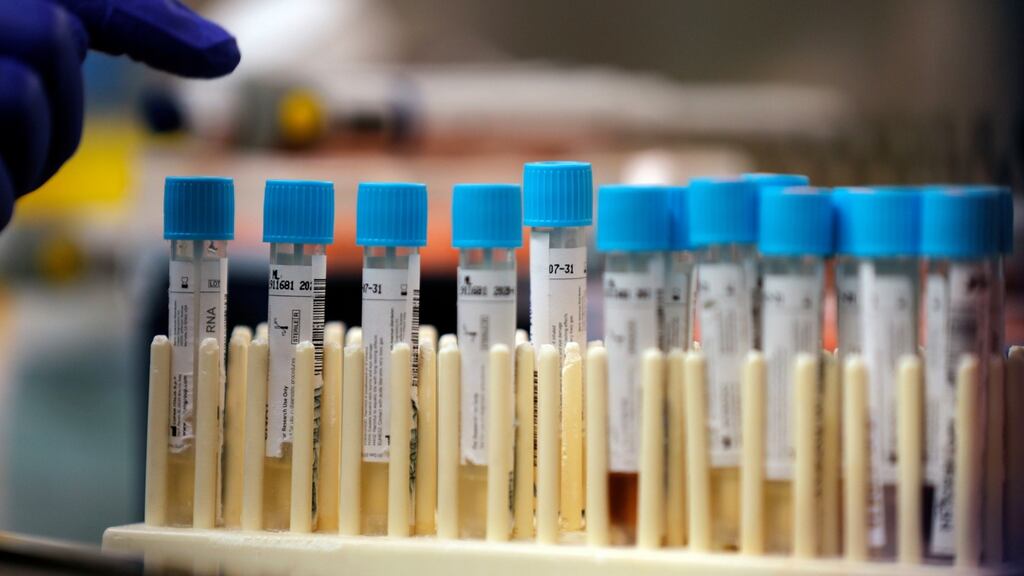 Nursing homes and residential facilities will still have to send tests to labs but conducting their own testing would allow the sector to become a priority. Photograph: Gerald Herbert/ AP Photo