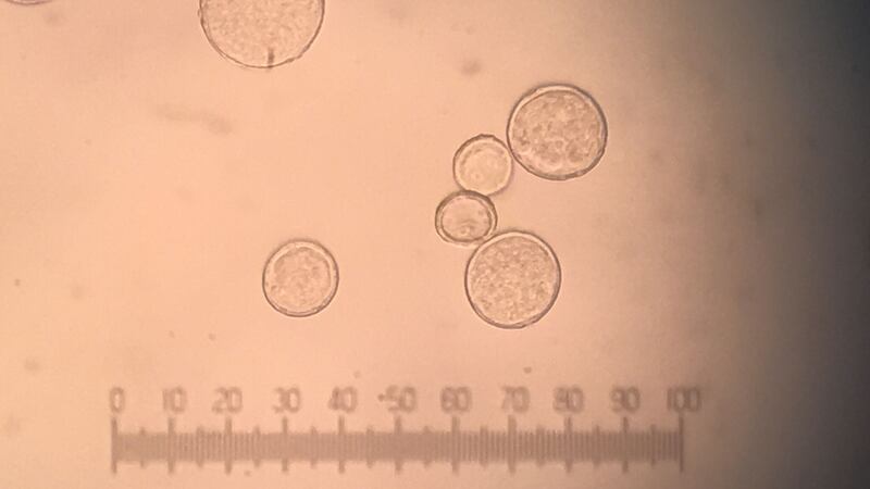 Plantago lanceolata pollen grains