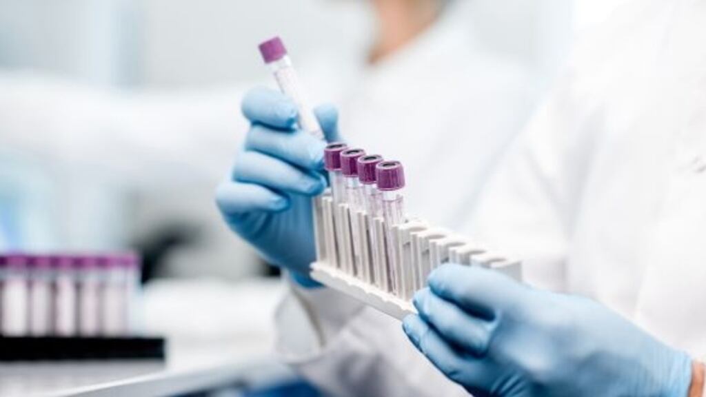 Fusion Antibodies said it is positive about the coming 12 months.