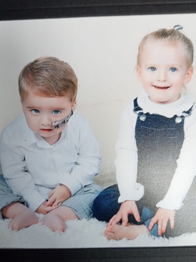 Indie and Ollie: Indie adores Ollie and likes to introduce him to people, explaining “this is my brother, he has a tube”