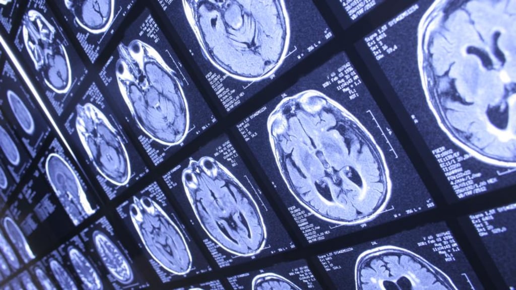 Records glitch: a software flaw means some MRIs, X-rays, CT scans and ultrasounds have been archived incorrectly. Photograph: E+/Getty
