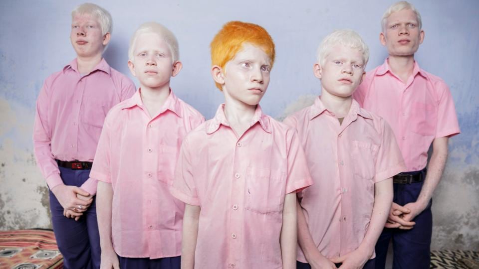 This picture by South African photographer Brent Stirton, Getty Images won 1st Prize in People Staged Portraits Singles category of the 57th World Press Photo Contest. Photograph: Brent Stirton/EPA/Bren Stirton