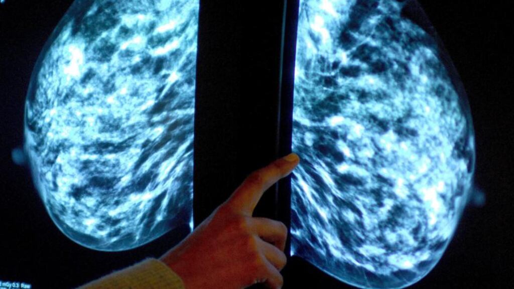 File photo of a mammogram showing a woman’s breast. A simple blood test could offer many women an early warning of breast cancer even if they do not inherit genes linked to the disease. Photograph: Rui Vieira/PA Wire