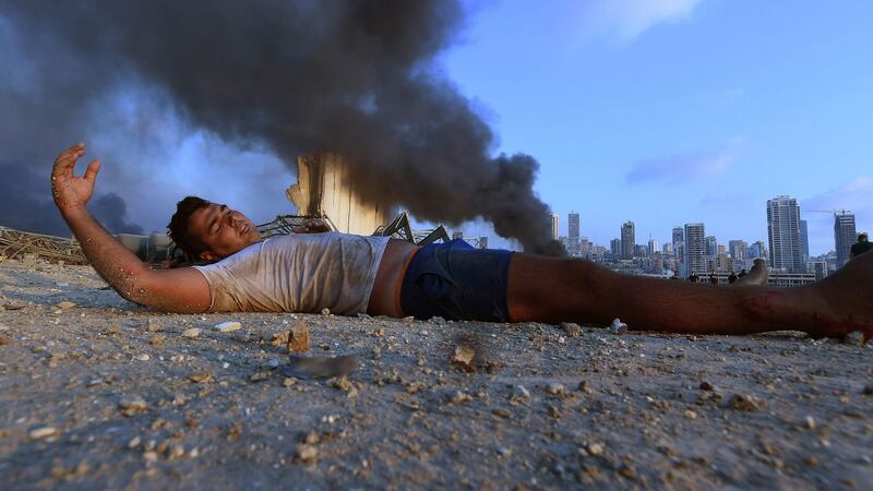 A wounded boy lies on the ground amid debris near the scene of Tuesday’s explosion at Beirut port. Photograph: AFP via Getty Images