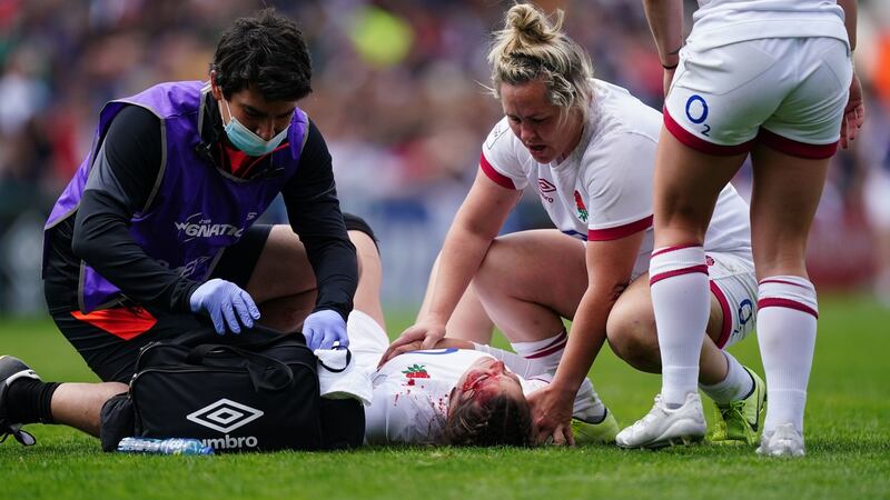 England’s Jess Breach lies covered in blood after a challenge during the TikTok Women’s Six Nations match at Mattioli Woods Welford Road Stadium, Leicester. Photograph: Mike Egerton/PA Wire