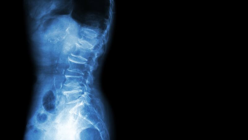 ‘My rheumatologist told me that it is a common phenomenon for women’s pain to be dismissed or ignored’