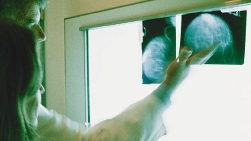 Doctors discuss cancer treatment (above). Minister of State John Halligan said: “We want to increase the five-year survival rate of patients with all cancer types from the current 59 per cent and to ensure that cancer survivors have a high quality of life.” File photograph: Getty Images