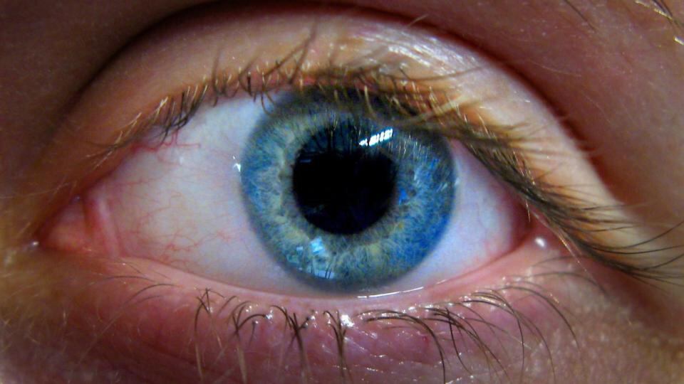 A bionic eye might offer some hope to people with retinitis pigmentos.