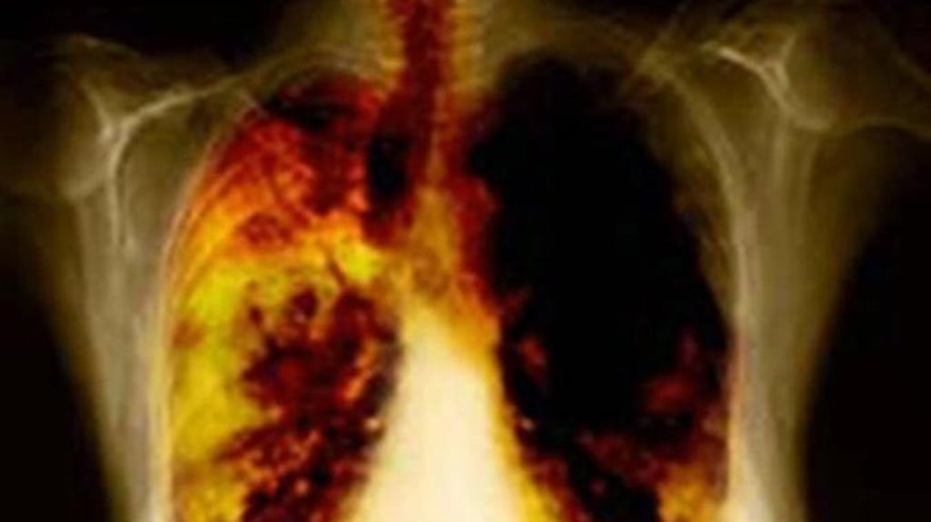 The German research raises the possibility of a vaccine that can be tailored for any kind of cancer, or even new versions of a disease that evolve as it progresses within the same patient. Photograph: PA Wire