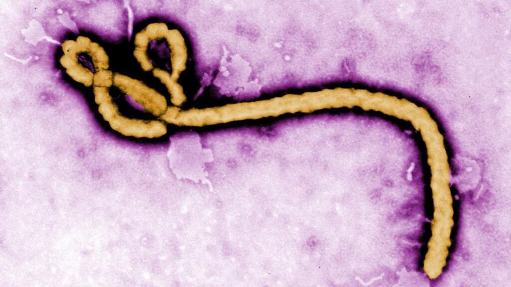Undated Centers for Disease Control and Prevention (CDC) handout photo of the Ebola virus. Photograph: Frederick Murphy/CDC/PA Wire