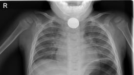 Boy left with battery in throat for nine days receives apologies from HSE and doctor