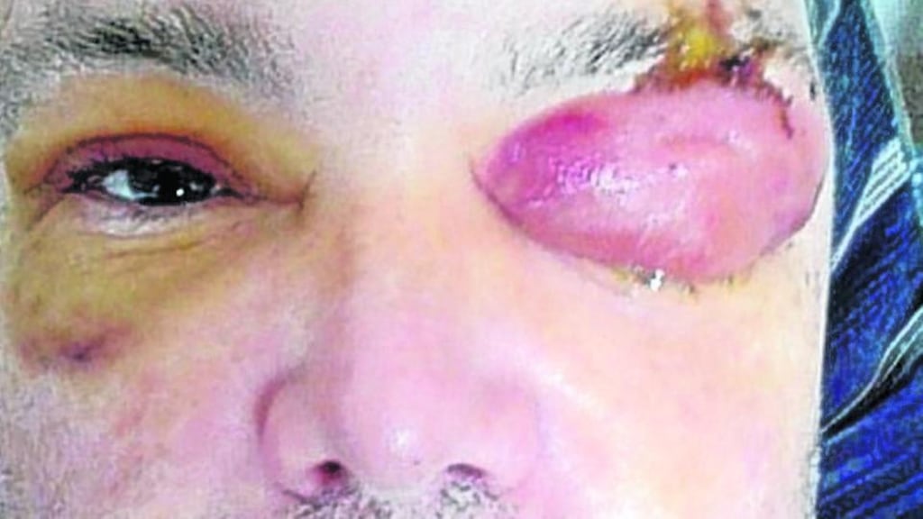 Garda Sgt Dave Haughney who was assaulted when he and a colleague made a routine traffic stop in Cork in 2014. Photograph: Provision