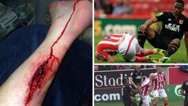 Tackle on Stephen Ireland by Maynor Figueroa condemned by Mark Hughes