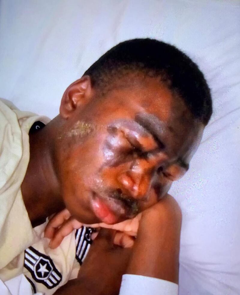 Tega Agberhiere suffered life-changing injuries in an acid attack on April 25th 2019.