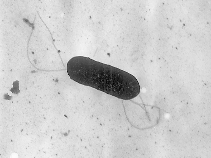 A listeria monocytogenes bacterium, responsible for the food-borne illness listeriosis, under the microscope. Photograph: Elizabeth White/Centers for Disease Control and Prevention via The New York Times