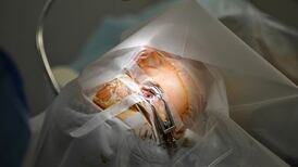 Vision restored to 12 US children with stem-cell lenses