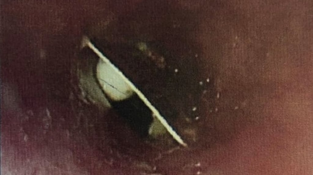 The tramadol pill packet was swallowed by the woman in the middle of the night. Photograph: BMJ Journals/PA