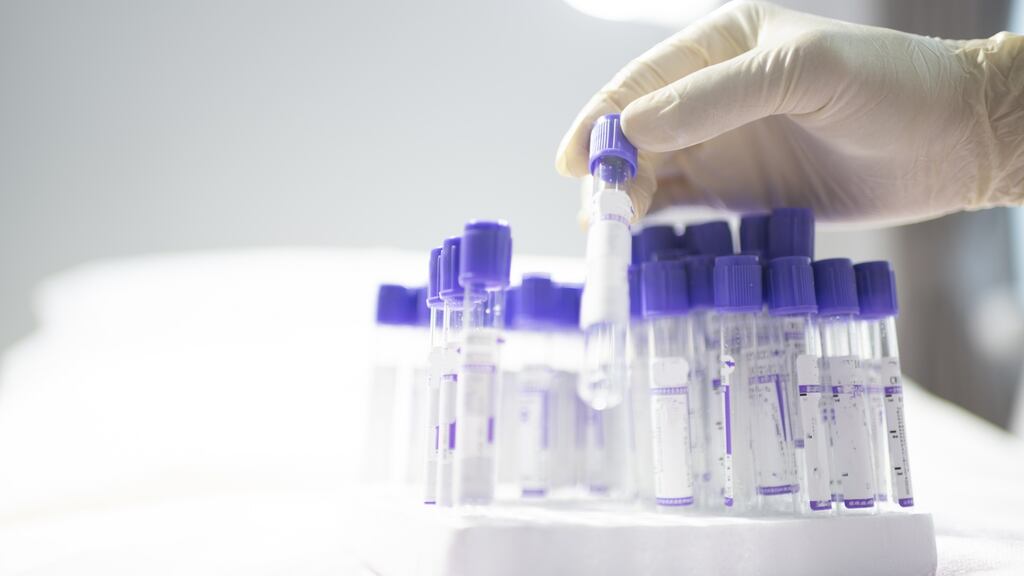 Thousands of procedures and outpatient appointments are likely to be cancelled as a result of the industrial action by almost 2,000 members of the Medical Laboratory Scientists Association. Photograph: iStock