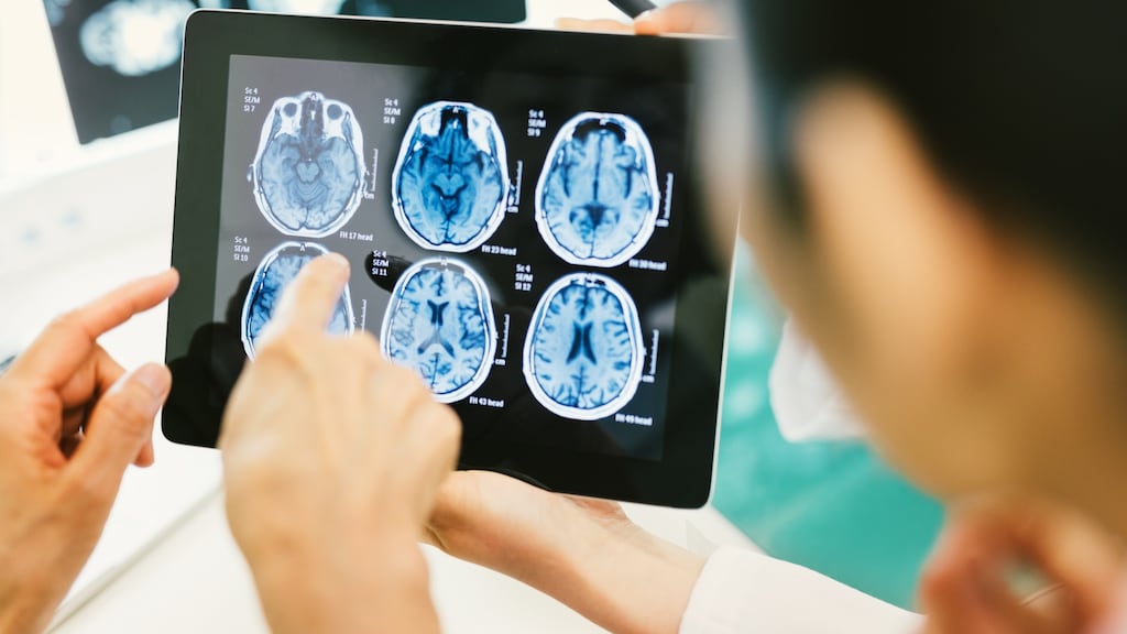 The researchers said they would use the data to build a brain tumour information system and ‘interrogate biologic and genetic data across a range of tumour types’.  Photograph: iStock