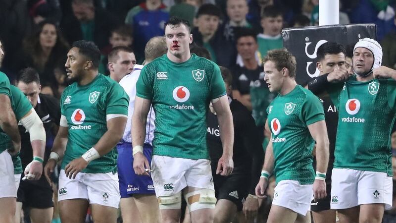 James Ryan comes away with a bloodied nose. Photo: Niall Carson/PA Wire