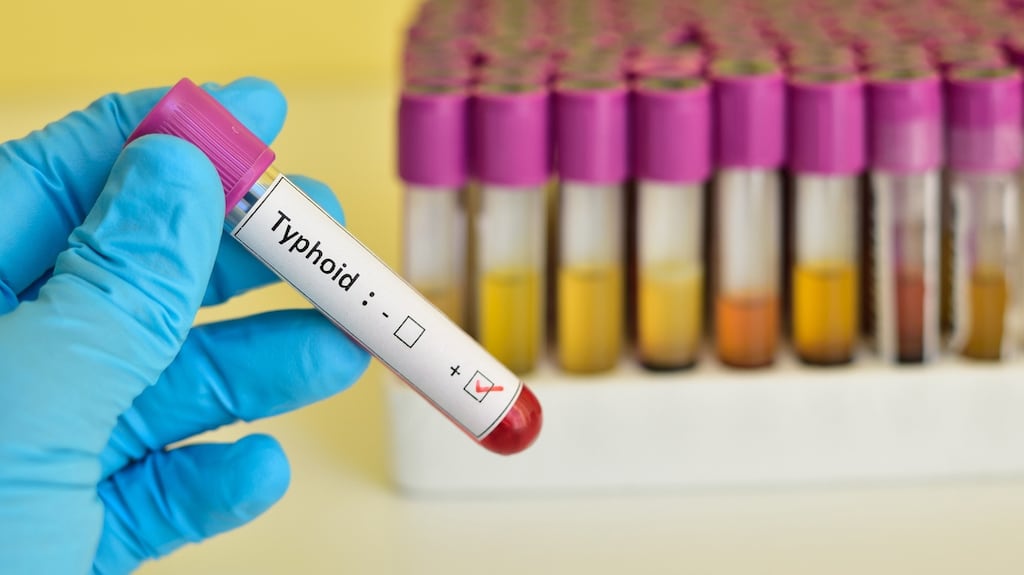 Last year, Ireland East Hospital Group contacted up to 70 people who were treated at Wexford General Hospital at the same time as a patient confirmed as having typhoid fever. File photograph: Getty