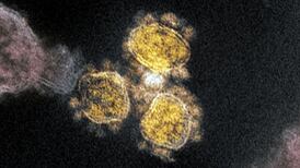 New blood test predicts which Covid-19 patients will develop severe infection