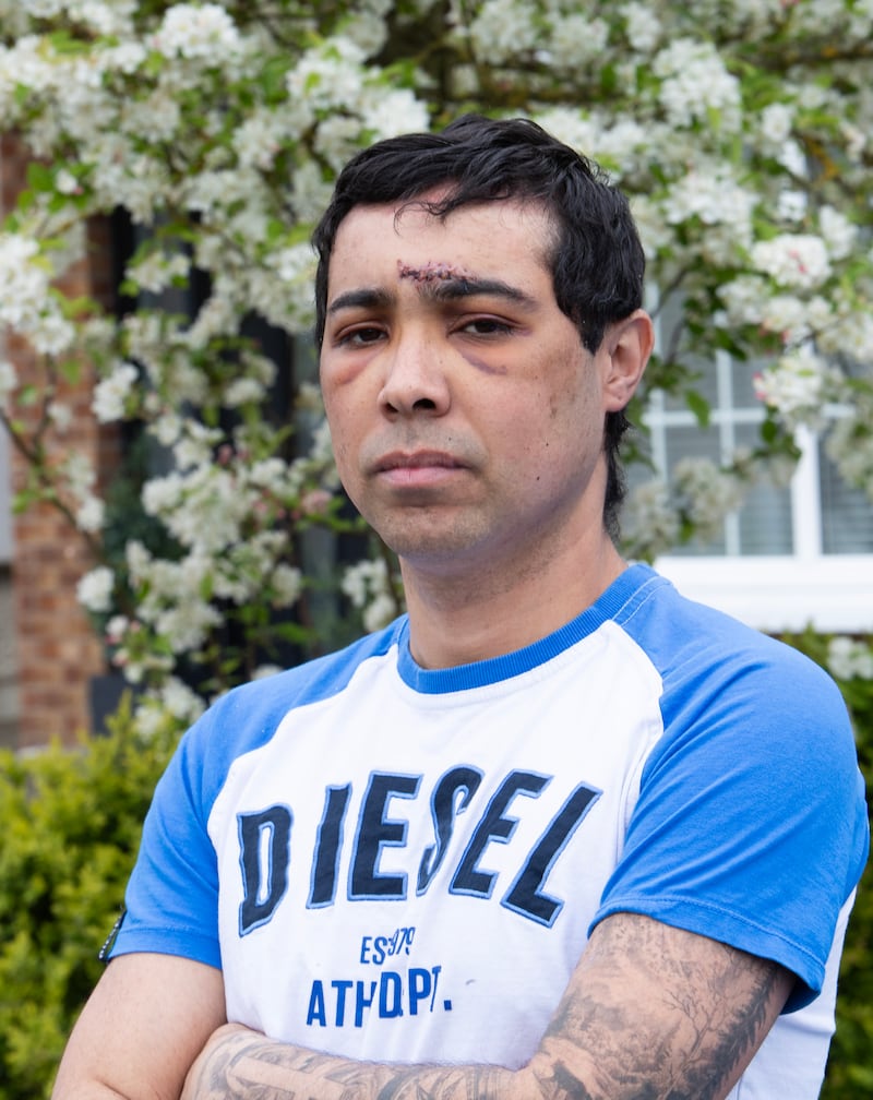 Roberto Gomes dos Sanos jnr. Photograph: Liam Burke/Press 22