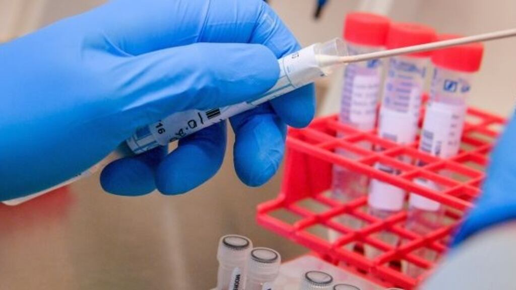 Dr Fergal Hickey advised those who are feeling well to continue following the cocooning rules and if they have mild symptoms to stay at home. Photograph: Ben Birchall/PA Wire.